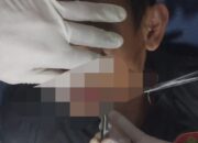 Syukuran Berujung Petaka : Oknum Kades di Katingan Bacok Warga Pakai Mandau